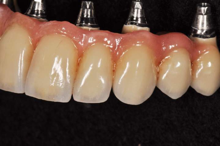 Dental Laboratory