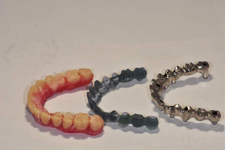 Ceramic Crowns Melbourne
